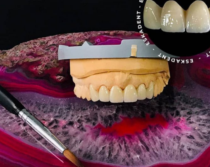 CAD-CAM Zirkon Porselen Kuron